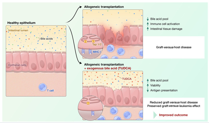 Bile acids regulate intestinal antigen presentation and reduce graft-versus-host disease without impairing the graft-versus-leukemia effect