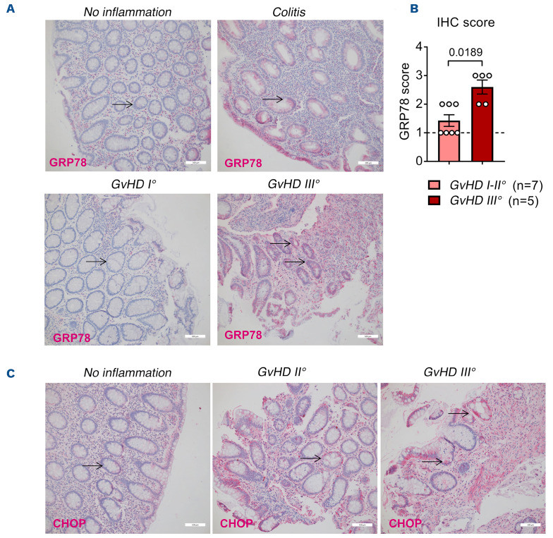 Therapeutic targeting of endoplasmic reticulum stress in acute graft-versus-host disease