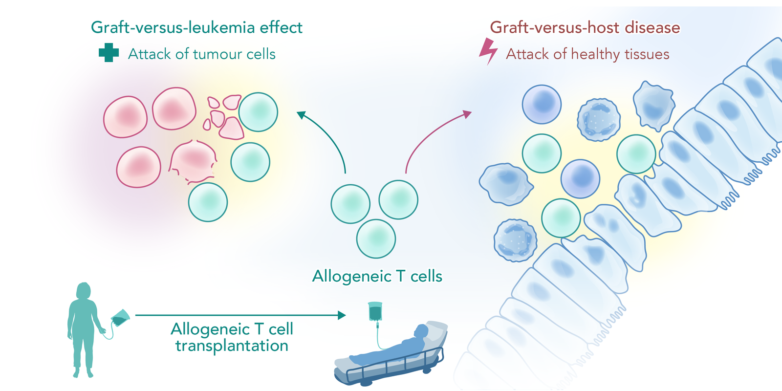 Graft-versus-host disease